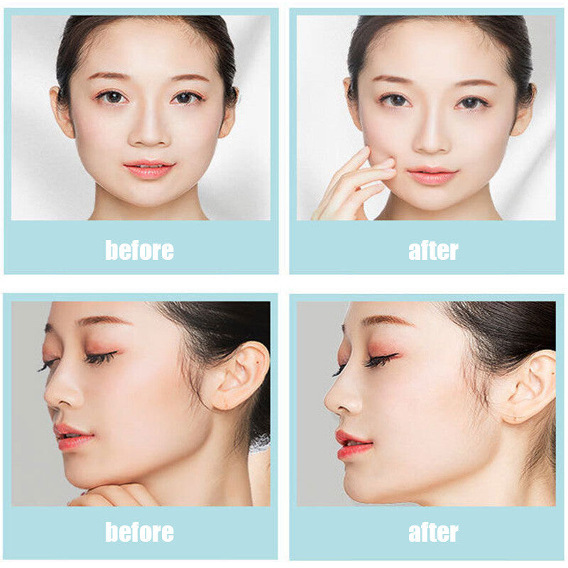 Magic Lifting Nose Up Shaping Straightening Shaper Bridge Clip Face Corrector`